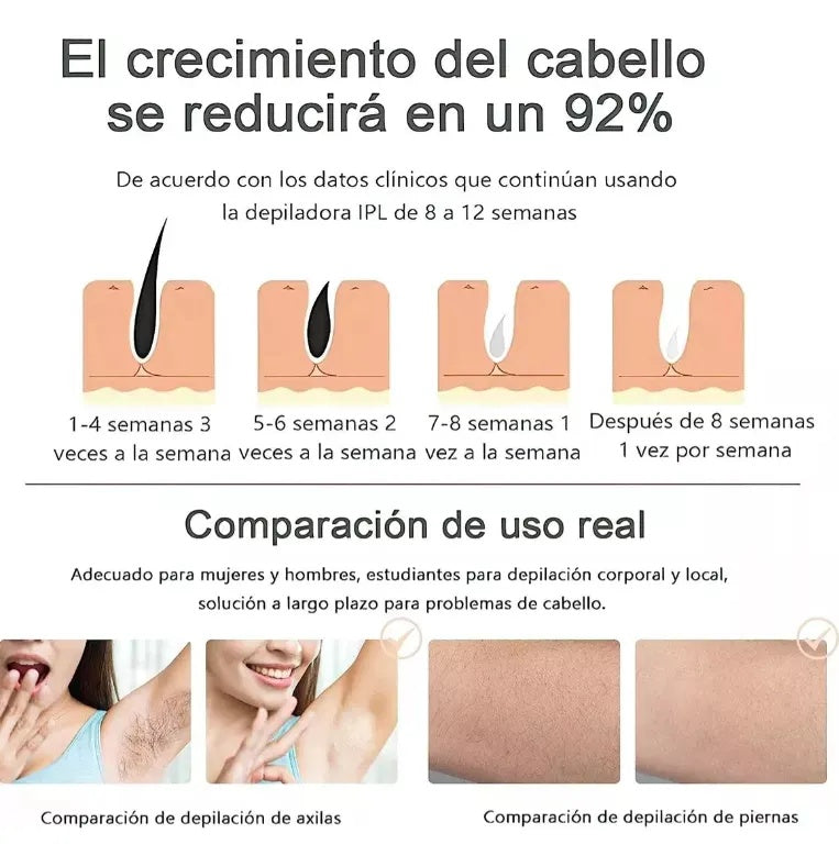 Depiladora Definitiva Ipl/laser - VelvetSmooth IPL®